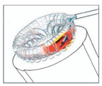 Mi motor está protegido por la sonda, puedo sobrecargarle, está protegido… #ErroresComunes nº3